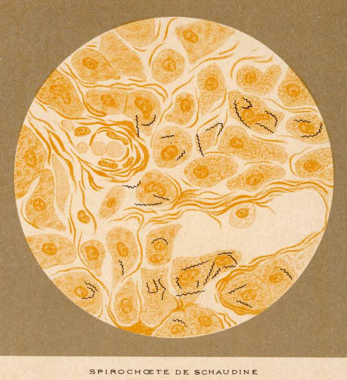 Le Siècle des vérolés. La Renaissance européenne face à la syphilis